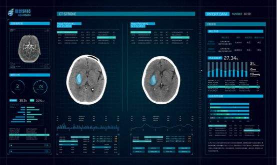 healthcare AI companies in China 