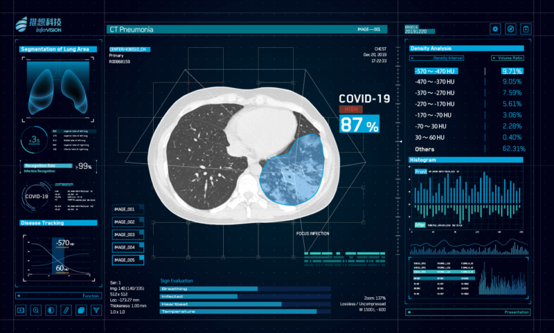 Tech advancements from the Coronavirus in China to help reading CT scans